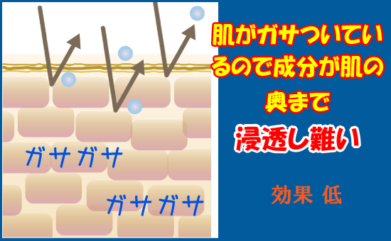 ニキビの肌状態